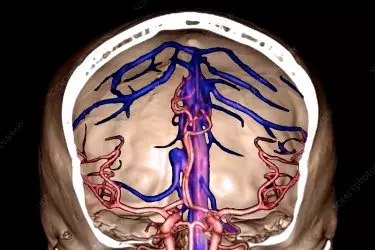 best diagnostic centre for ct angiography, best diagnostic centre in Bhiwadi, ct renal angiography, ct angiography neck vessels, ct angiography of the heart, ct angiography of peripheral vessels, ct angiography of the brain