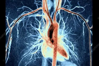 best diagnostic centre in Bhiwadi, mr angiography test in Bhiwadi cost, best mri centre in Bhiwadi, where to get mr angiography test in Bhiwadi, best mri machine in Bhiwadi, 3 tesla mri in Bhiwadi