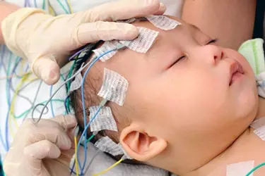 EEG Test in Bhiwadi by Neurologist, EEG Test for Epilepsy in Bhiwadi, Cost of EEG Test in Bhiwadi, Where can EEG Test be done in Bhiwadi, Best Neurology Hospital for EEG Test in Bhiwadi