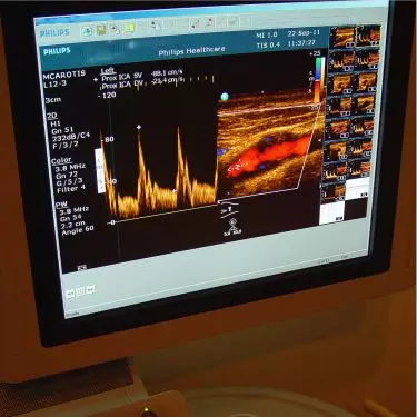 Best Colour Doppler Centre in Bhiwadi