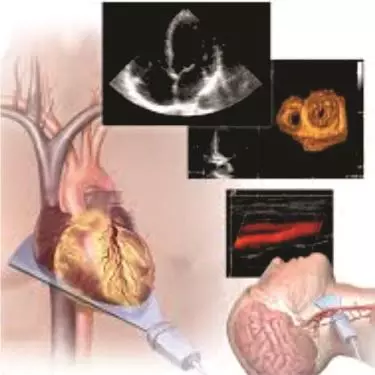 Best Echocardiography Centre in Bhiwadi