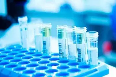 Best Pathology Lab in Bhiwadi, Blood Testing Laboratory in Bhiwadi, Blood test in bhiwadi