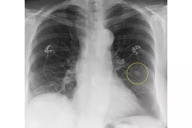 Digital Xray In Bhiwadi, Digital Xray In bhiwadi